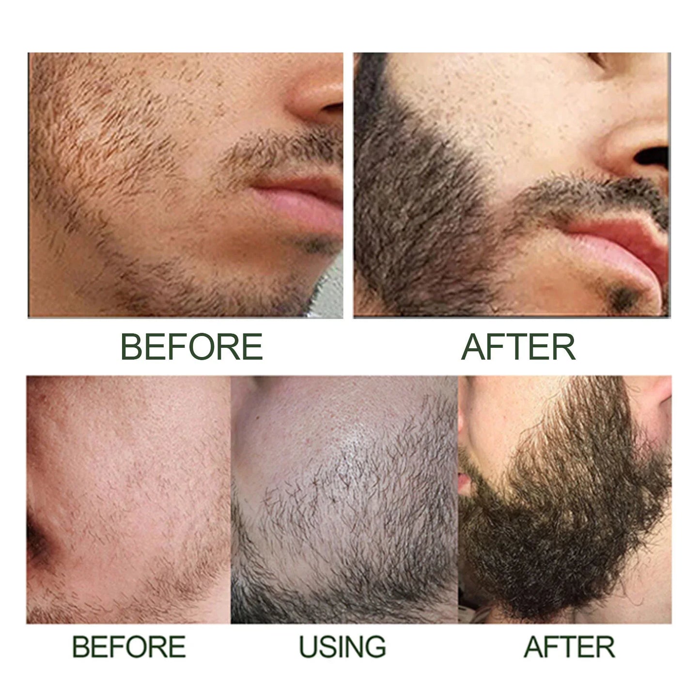 Men Beard Growth Serum Hair Styling Essential Oil Grow Beard Thicker anti Hair Loss Products Softening Moisturizing Beard Liquid